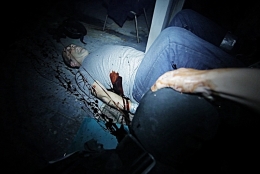 Photo2
